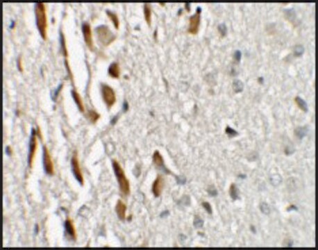 Anti-TSHZ3 antibody produced in rabbit affinity isolated antibody