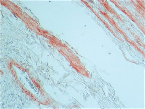 Monoclonal Anti-Tenascin antibody produced in mouse clone BC-24, ascites fluid