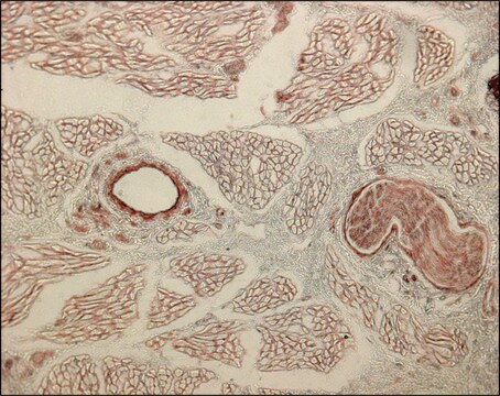 モノクロナール抗コラーゲン, IV型 マウス宿主抗体 clone COL-94, ascites fluid