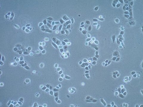 Linia komórkowa raka płaskonabłonkowego UM-SCC-22A UM-SCC-22A is a unique head and neck squamous carcinoma cell line obtained from the surgical resection of the primary cancer of the hypopharynx of a female patient and is a suitable in vitro model of H&amp;N carcinoma studies.