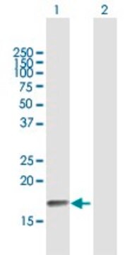 Anti-PPP3R2 antibody produced in mouse purified immunoglobulin, buffered aqueous solution