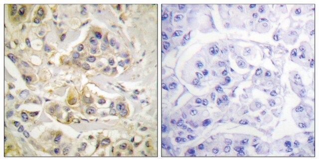 Anti-AHR antibody produced in rabbit affinity isolated antibody