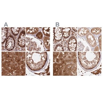 Anti-GBE1 antibody produced in rabbit Prestige Antibodies&#174; Powered by Atlas Antibodies, affinity isolated antibody, buffered aqueous glycerol solution