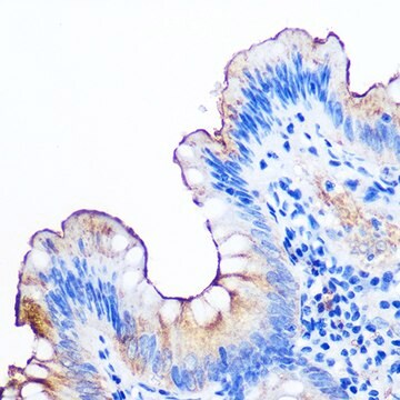 Anti-CEACAM1 Antibody, clone 0S9Z7, Rabbit Monoclonal