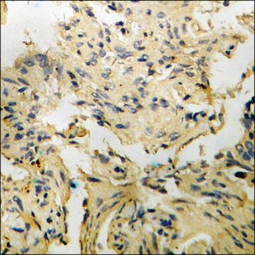 Anti-phospho-p130 Cas (pTyr410) antibody produced in rabbit affinity isolated antibody