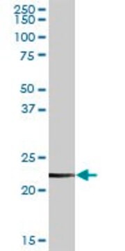 Anti-CLTB antibody produced in rabbit purified immunoglobulin, buffered aqueous solution