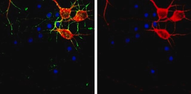 抗MAP-2 from rabbit, purified by affinity chromatography