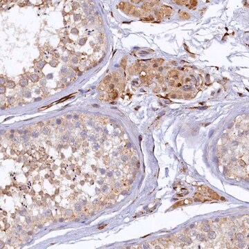 Anti-ARL11 antibody produced in rabbit Prestige Antibodies&#174; Powered by Atlas Antibodies, affinity isolated antibody, buffered aqueous glycerol solution