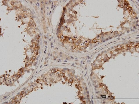 Monoclonal Anti-PSMB4 antibody produced in mouse clone 6G7-E8, purified immunoglobulin, buffered aqueous solution