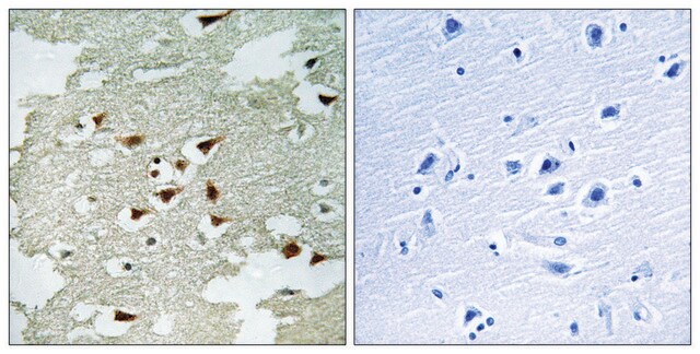 抗-AKT 兔抗 affinity isolated antibody