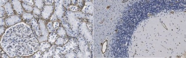 Anticorps anti-fibronectine, anticorps domaine de liaison cellulaire, clone&nbsp;P1H11 clone P1H11, from mouse