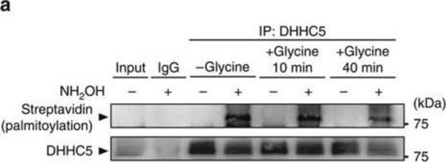 抗-ZDHHC5 兔抗 Prestige Antibodies&#174; Powered by Atlas Antibodies, affinity isolated antibody, buffered aqueous glycerol solution