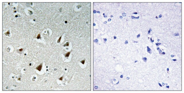 Anti-ZHX2 antibody produced in rabbit affinity isolated antibody