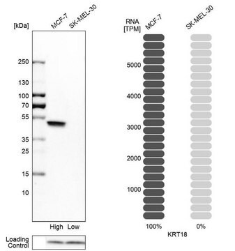 抗ENSG00000177083抗体 ウサギ宿主抗体 Prestige Antibodies&#174; Powered by Atlas Antibodies, affinity isolated antibody, buffered aqueous glycerol solution