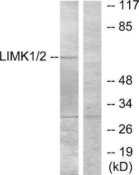 Anti-LIMK1 antibody produced in rabbit affinity isolated antibody