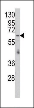 ANTI-RARS2 (C-TERM) antibody produced in rabbit IgG fraction of antiserum, buffered aqueous solution