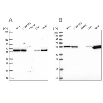 Anti-PRPF19 antibody produced in rabbit Prestige Antibodies&#174; Powered by Atlas Antibodies, affinity isolated antibody, buffered aqueous glycerol solution