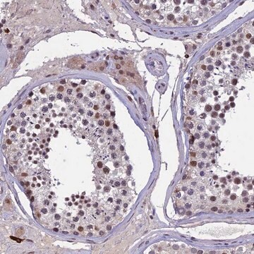 Anti-RNF40 antibody produced in rabbit Prestige Antibodies&#174; Powered by Atlas Antibodies, affinity isolated antibody, buffered aqueous glycerol solution