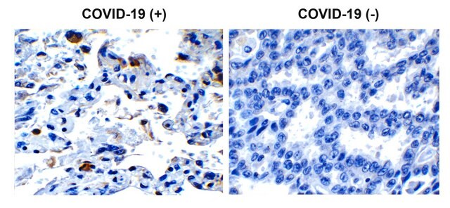 Anti-SARS-CoV-2 (COVID-19) Envelope antibody produced in rabbit affinity isolated antibody