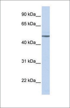 抗ADRB1抗体 ウサギ宿主抗体 affinity isolated antibody