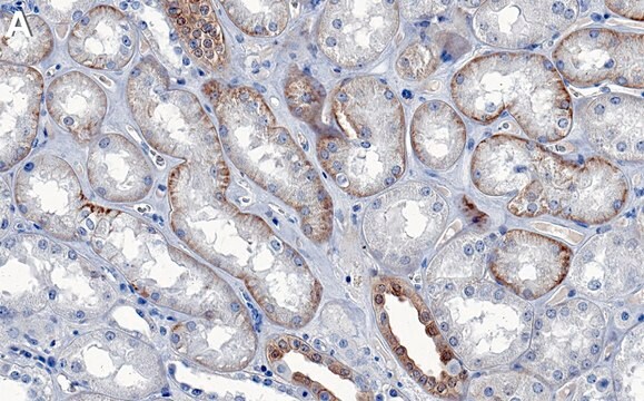 Anti-NDRG1 Antibody, clone 1C11 ZooMAb&#174; Rabbit Monoclonal recombinant, expressed in HEK 293 cells