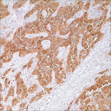 Calretinin Rabbit Polyclonal Antibody