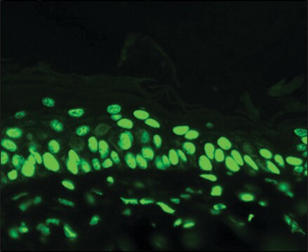 Monoclonal Anti-Acetylated Lysine antibody produced in mouse clone 7F8, 1&#160;mg/mL, purified immunoglobulin