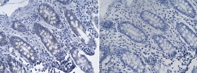 Anti-RNF213 Antibody, clone 1D10 ZooMAb&#174; Rabbit Monoclonal recombinant, expressed in HEK 293 cells