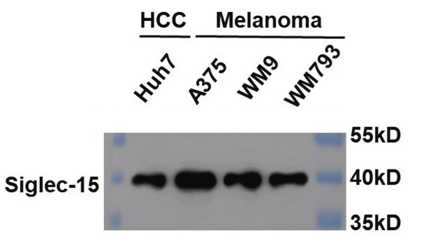 Anti-SIGLEC15 Antibody, clone 1B10 ZooMAb&#174; Rabbit Monoclonal recombinant, expressed in HEK 293 cells