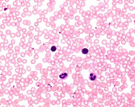 Hemacolor&#174; Rapid staining of blood smear Solution 2: colour reagent red