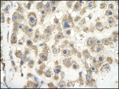 抗GPC3抗体 IgG fraction of antiserum