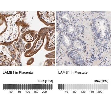 Anti-LAMB1 antibody produced in rabbit Ab2, Prestige Antibodies&#174; Powered by Atlas Antibodies, affinity isolated antibody, buffered aqueous glycerol solution