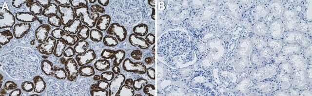 Anti-Collectin-11 Antibody, clone 1I5-H2 ZooMAb&#174; Rabbit Monoclonal recombinant, expressed in HEK 293 cells