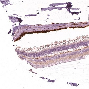 Anty-ARMS2 Prestige Antibodies&#174; Powered by Atlas Antibodies, affinity isolated antibody