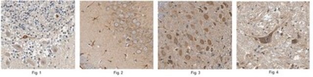 Anticorpo anti-receptor opioide Mu from rabbit, purified by affinity chromatography