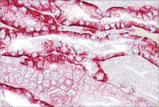 Anti-CDH16 antibody produced in rabbit affinity isolated antibody