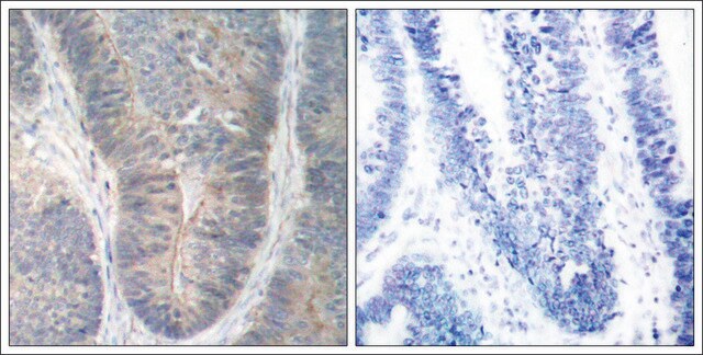 Anti-phospho-EIF2AK2 (pThr451) antibody produced in rabbit affinity isolated antibody