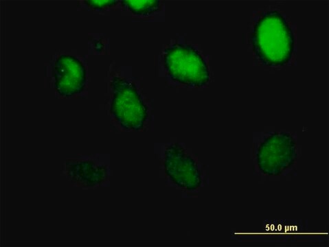 Anti-CSPG6 antibody produced in mouse purified immunoglobulin, buffered aqueous solution