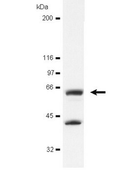 Anti-avian Src Antibody, clone EC10 clone EC10, Upstate&#174;, from mouse