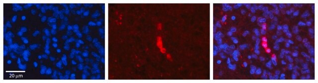 Anti-ACADVL antibody produced in rabbit affinity isolated antibody