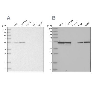 Anti-RBM17 antibody produced in rabbit Prestige Antibodies&#174; Powered by Atlas Antibodies, affinity isolated antibody, buffered aqueous glycerol solution