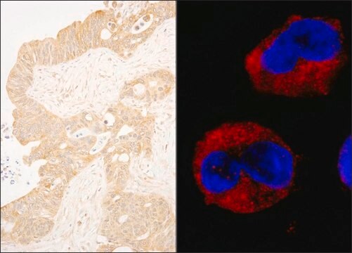 Rabbit anti-cAbl Antibody, Affinity Purified Powered by Bethyl Laboratories, Inc.