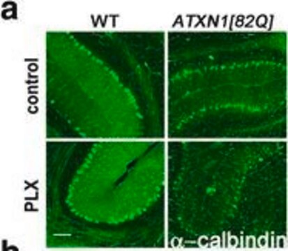 Monoklonaler Anti-Calbindin-D-28K-Antikörper in Maus hergestellte Antikörper clone CB-955, ascites fluid