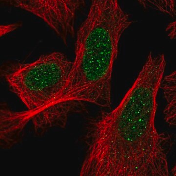 抗ACD抗体 ウサギ宿主抗体 Prestige Antibodies&#174; Powered by Atlas Antibodies, affinity isolated antibody