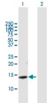 Anti-SLPI antibody produced in mouse purified immunoglobulin, buffered aqueous solution