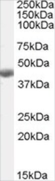 抗BHMT抗体 ヤギ宿主抗体 affinity isolated antibody, buffered aqueous solution