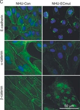 Anti-&#945;-Catenin antibody produced in rabbit whole antiserum