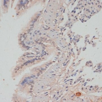 Anti-Phospho-PPP1CA-T320 antibody produced in rabbit