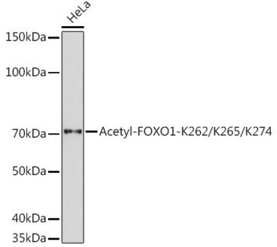 Anti-Acetyl-FOXO1-K262/K265/K274