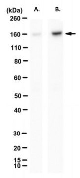 Anti-acetyl SMC3 (Lys105/106) Antibody purified antibody, clone 209f/A7, from mouse